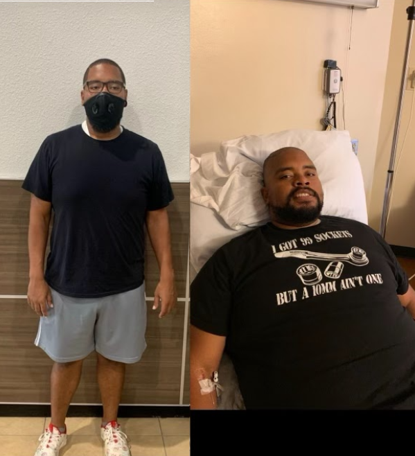 Marcus D. — Weight Loss transformation